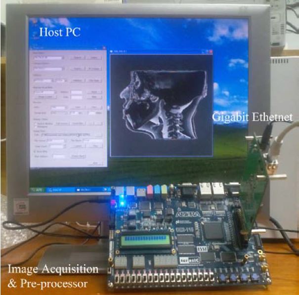 FPGA+GPGPU Platform for Single Photon Counting(SPC) X-ray Imaging